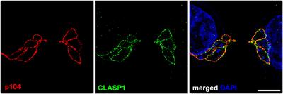 Theileria’s Strategies and Effector Mechanisms for Host Cell Transformation: From Invasion to Immortalization